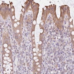 FAM208B Antibody, Novus Biologicals:Antibodies:Primary Antibodies